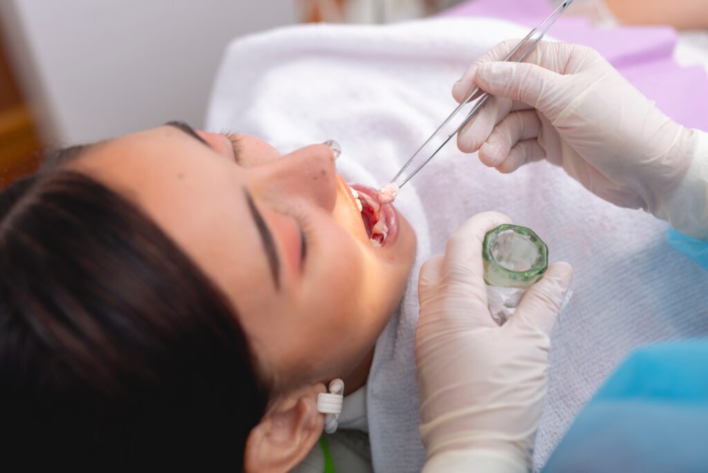 Fluoride Treatment Forney