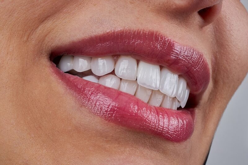 Cosmetic Dentistry Forney